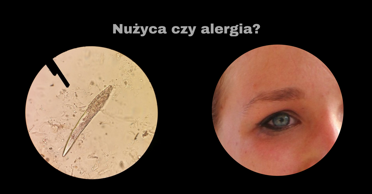 Czym są nużeńce